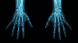 Become a forensic anthropologist