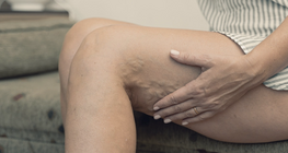 Venous thromboembolism in trauma patients