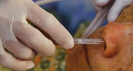 Assisting uncounscious patients with personal hygiene