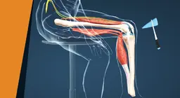 The leg that came to life