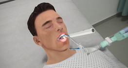 Oral care of patients with breathing tubes