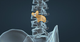 45° degrees oblique view of the lumbar spine