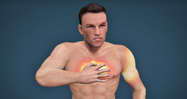 What you need to know about heart attacks