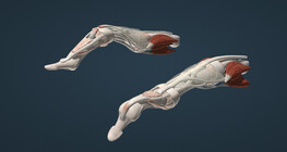 Swan-neck and boutonnière deformities