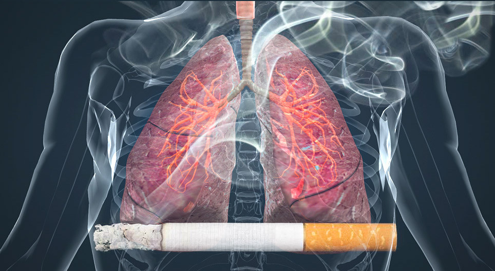 Effects of smoking on the lungs