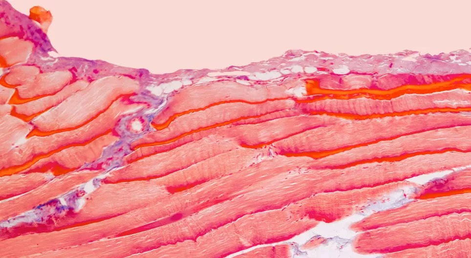 我們的肌肉由哪些組織組成？