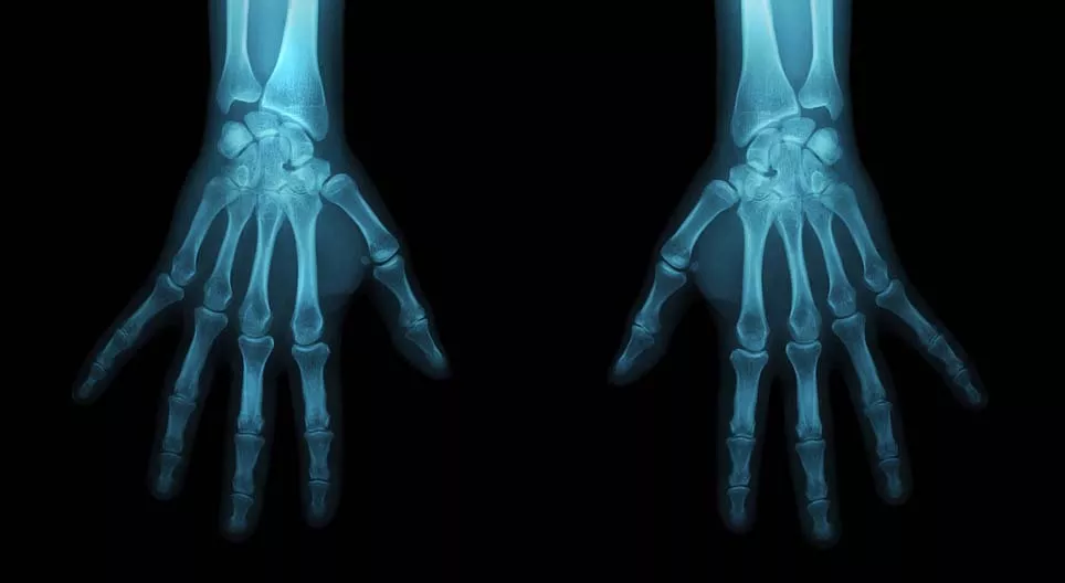 成為一名法醫人類學家