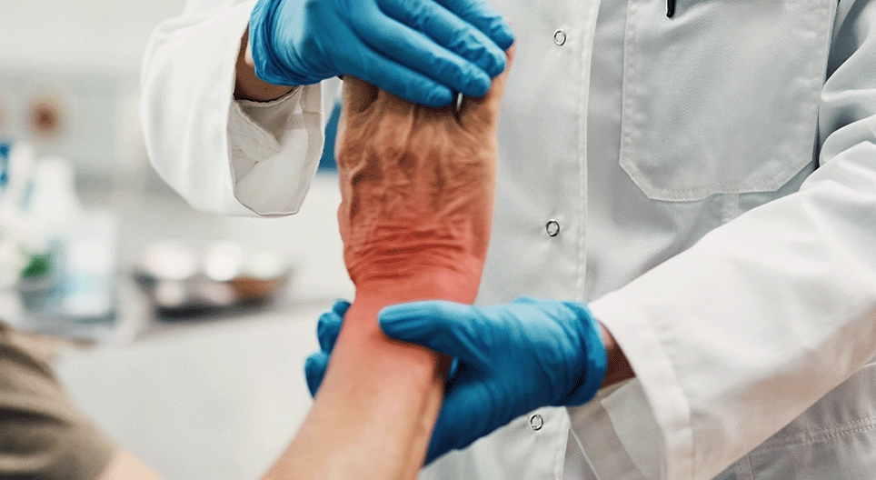 Other inflammatory disorders of the musculoskeletal system